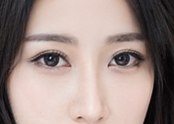 双眼皮增生期可以化妆吗？双眼皮增生期需要注意什么？