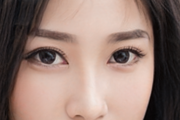 扇形双眼皮可以改成平行双眼皮吗？双眼皮修复需要多长时间？