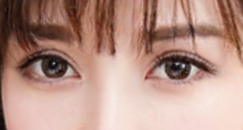 双眼皮术后痒是增生吗？