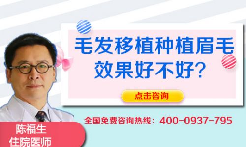 上海中医医院整形科眉毛种植方法有哪些
