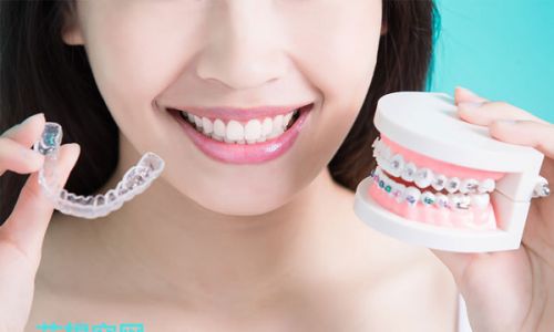牙齿种植体十大品牌？牙齿种植的优势有哪些？